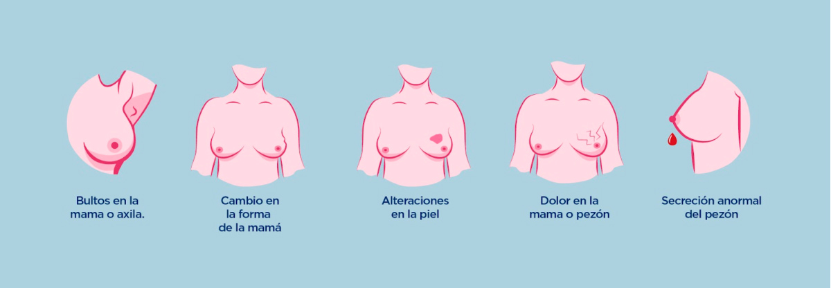 ¿Qué es el cáncer de mama y qué son los sarcomas? - Duet